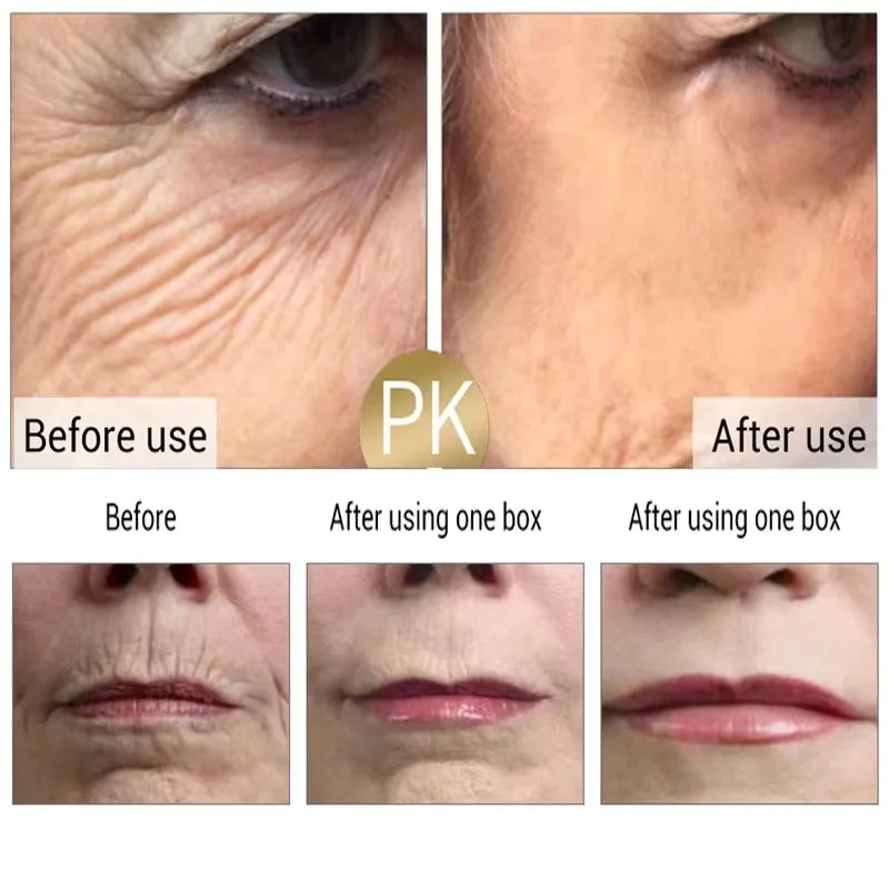 Instant Wrinkle Remover Face Cream - yourelevatedwellness