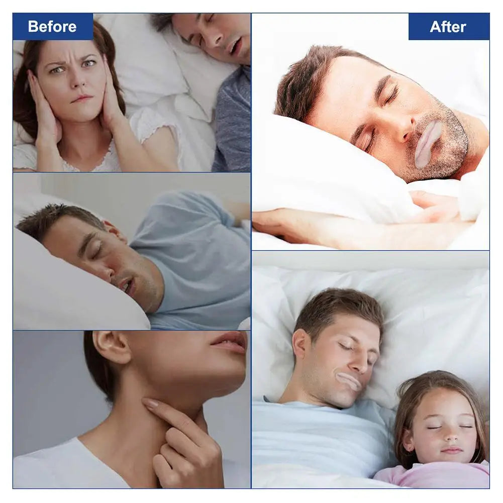 90pcs Anti-Snoring Mouth Tape Sleep Strips - yourelevatedwellness