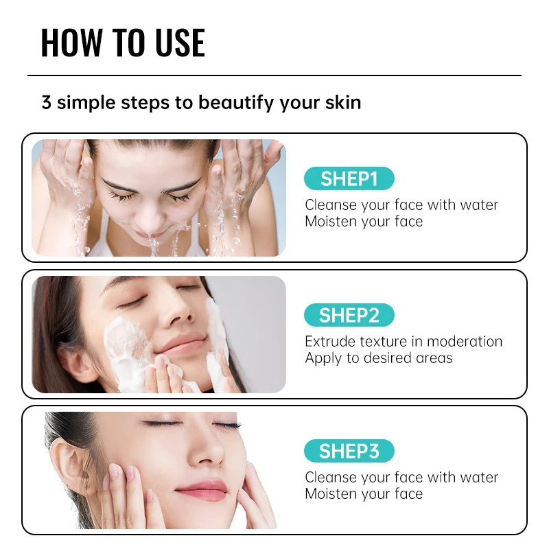Salicylic Acid Acne Removal Cream - yourelevatedwellness