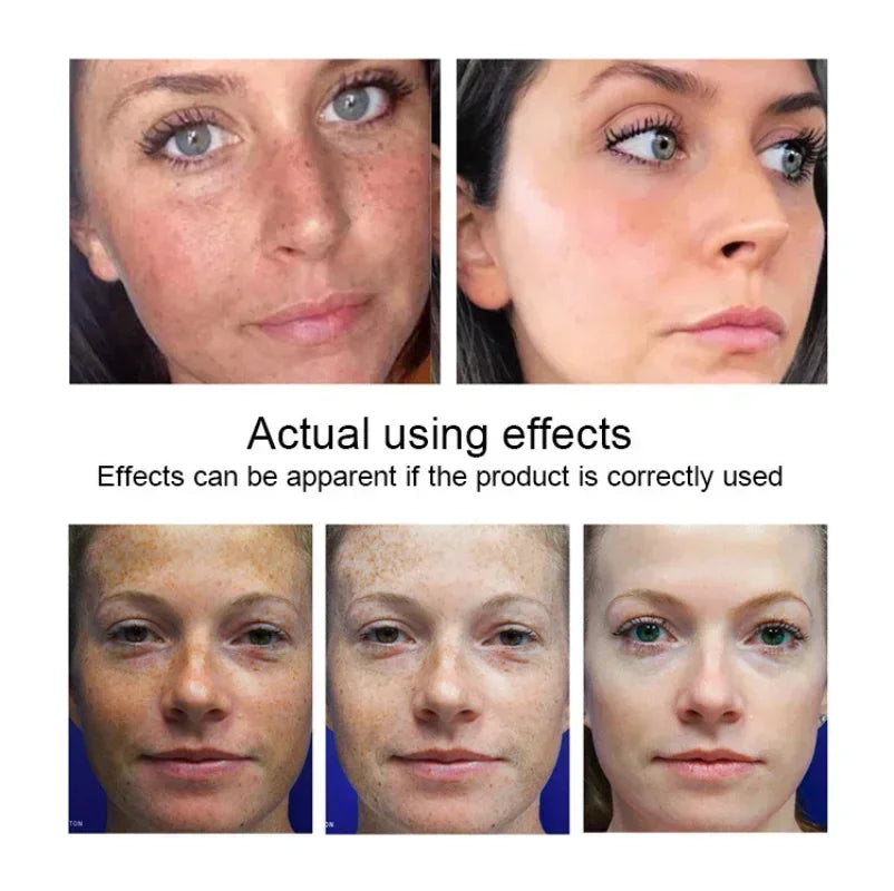 Instant Wrinkle Remover Face Cream - yourelevatedwellness