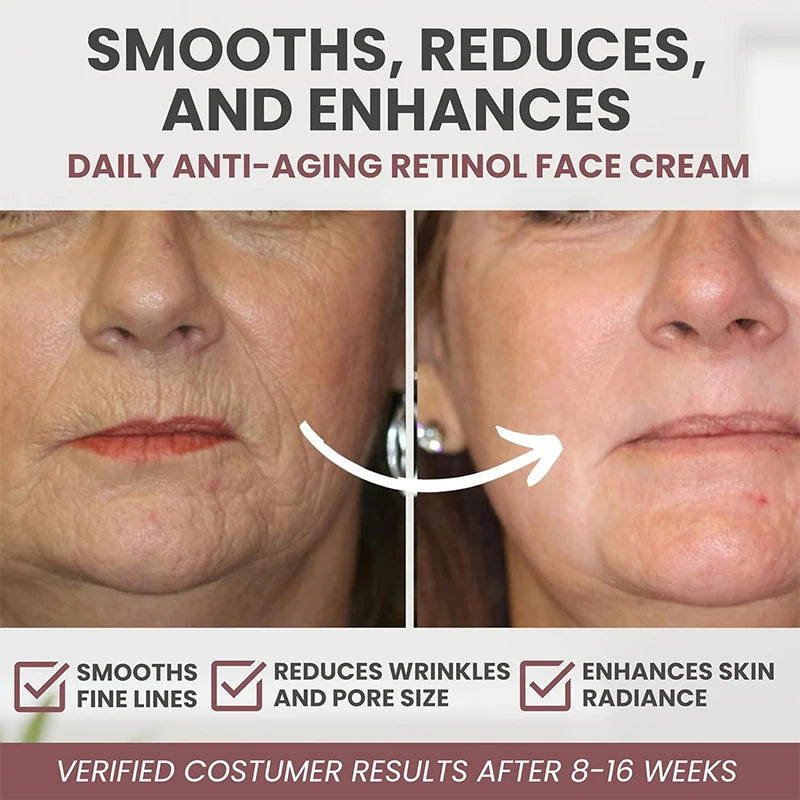 Instant Retinol Anti-Aging Cream - yourelevatedwellness
