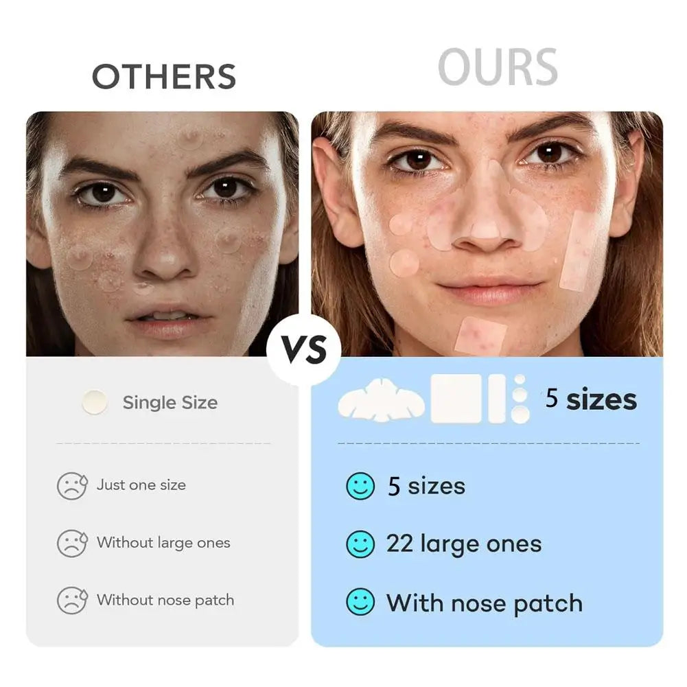 262/360Pcs Cute Colorful Pimple Patches Acne Treatment Stickers Invisible Acne Cover Face Spot Pimple Patch Skin Care Makeup yourelevatedwellness