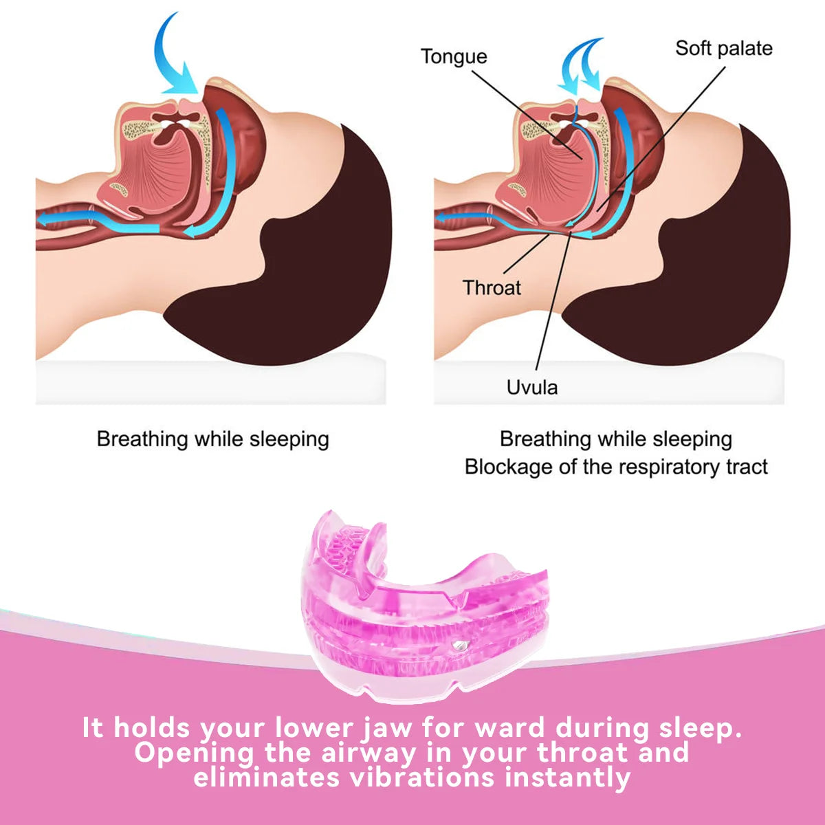 Anti-Snoring & Bruxism Mouth Guard - yourelevatedwellness