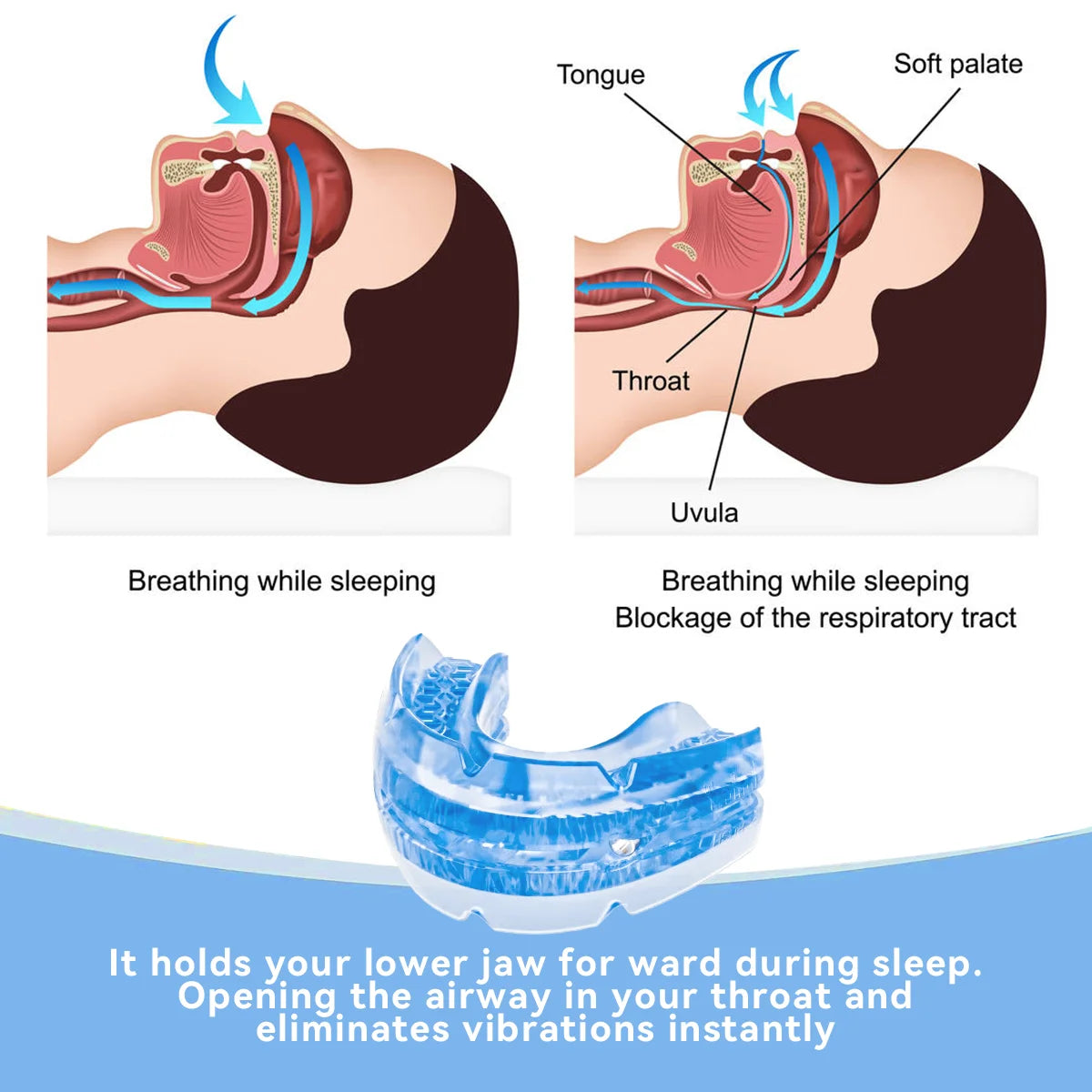 Anti-Snoring & Bruxism Mouth Guard - yourelevatedwellness