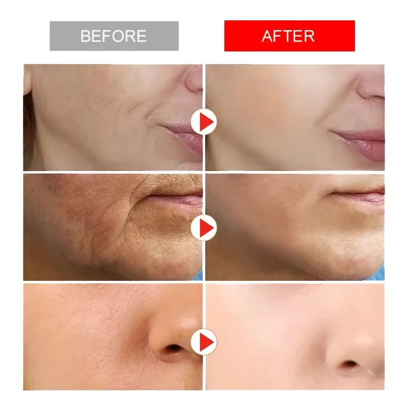 Instant Wrinkle Remover Face Cream - yourelevatedwellness