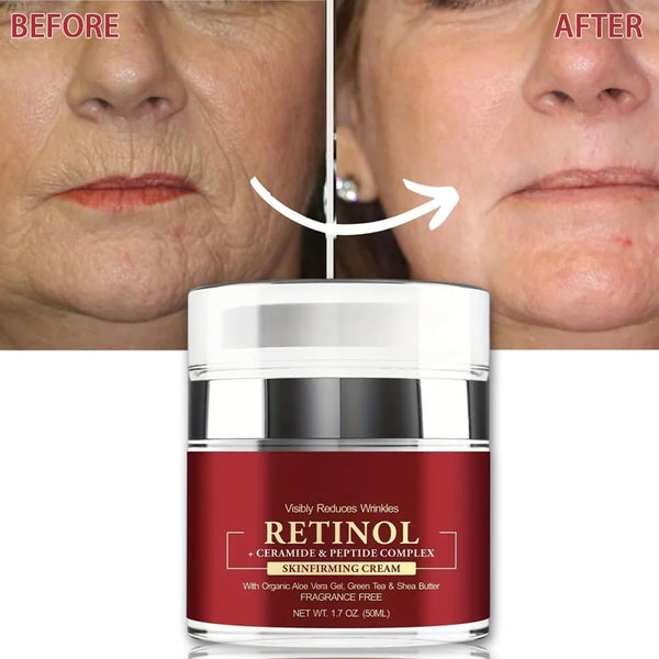 Instant Retinol Anti-Aging Cream - yourelevatedwellness