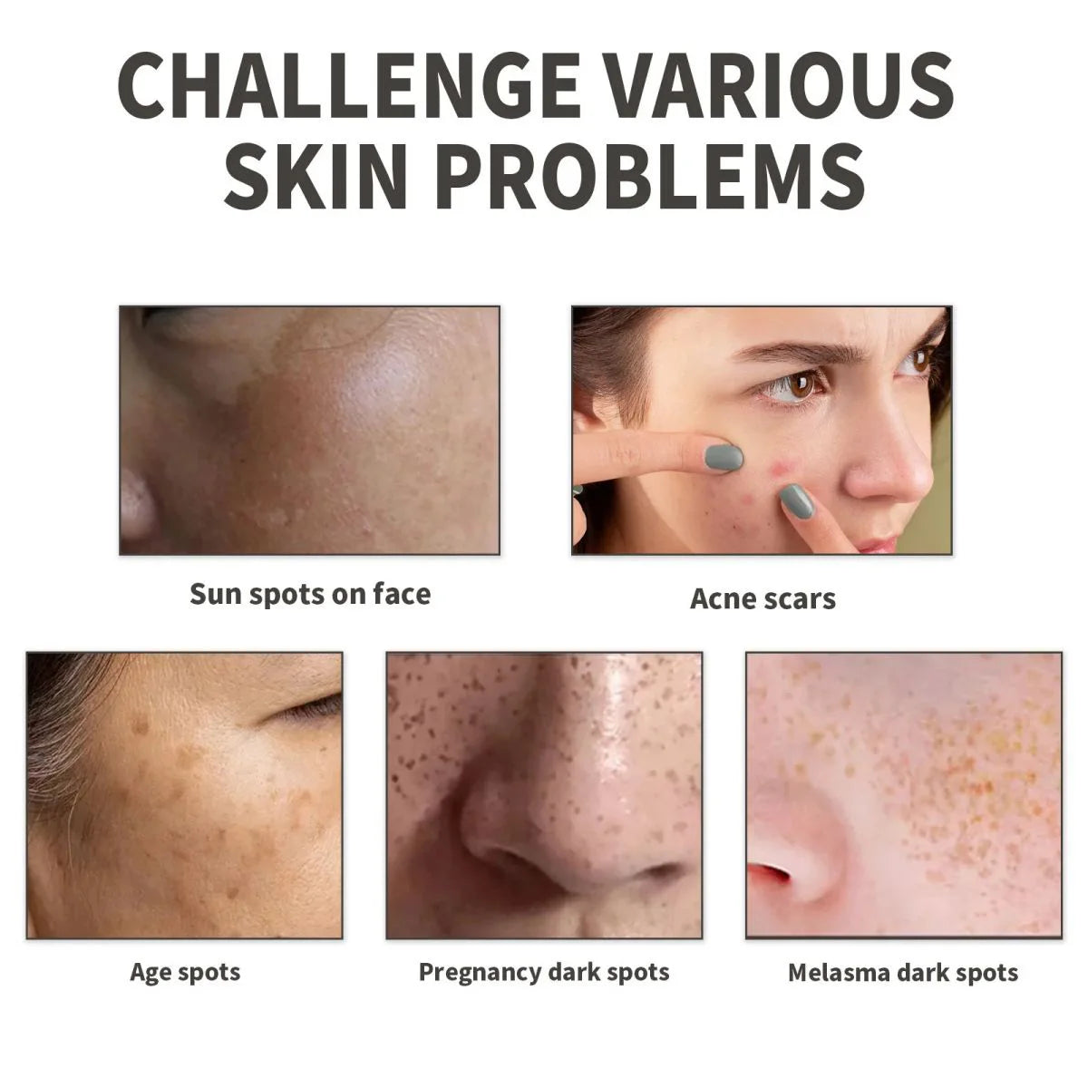 Vitamin B5 Face Serum – Hydrating, Repairing & Pore-Minimizing Facial Essence - yourelevatedwellness