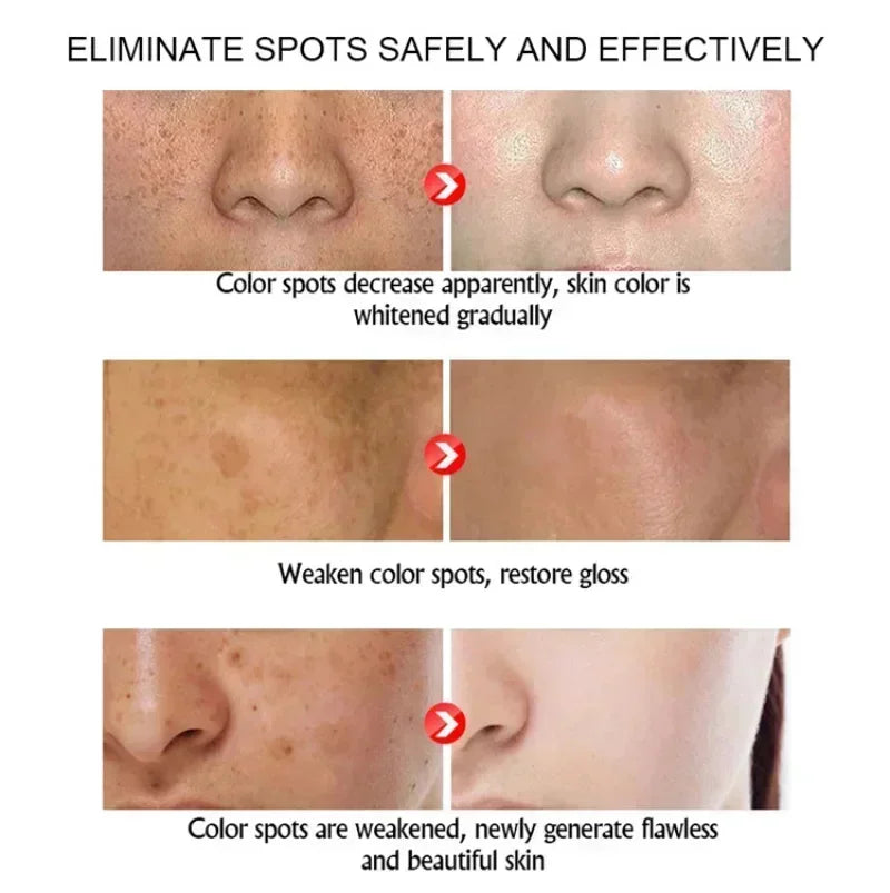Instant Wrinkle Remover Face Cream - yourelevatedwellness