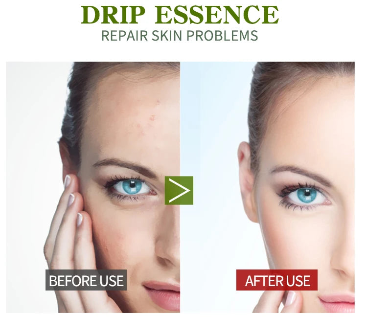 Vitamin B5 Face Serum – Hydrating, Repairing & Pore-Minimizing Facial Essence - yourelevatedwellness
