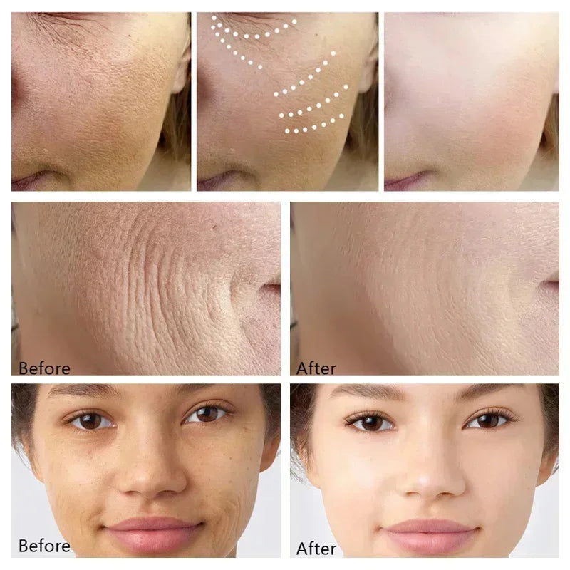 Instant Wrinkle Remover Face Cream - yourelevatedwellness