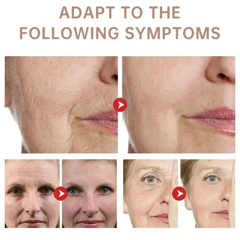 Instant Wrinkle Remover Face Cream - yourelevatedwellness
