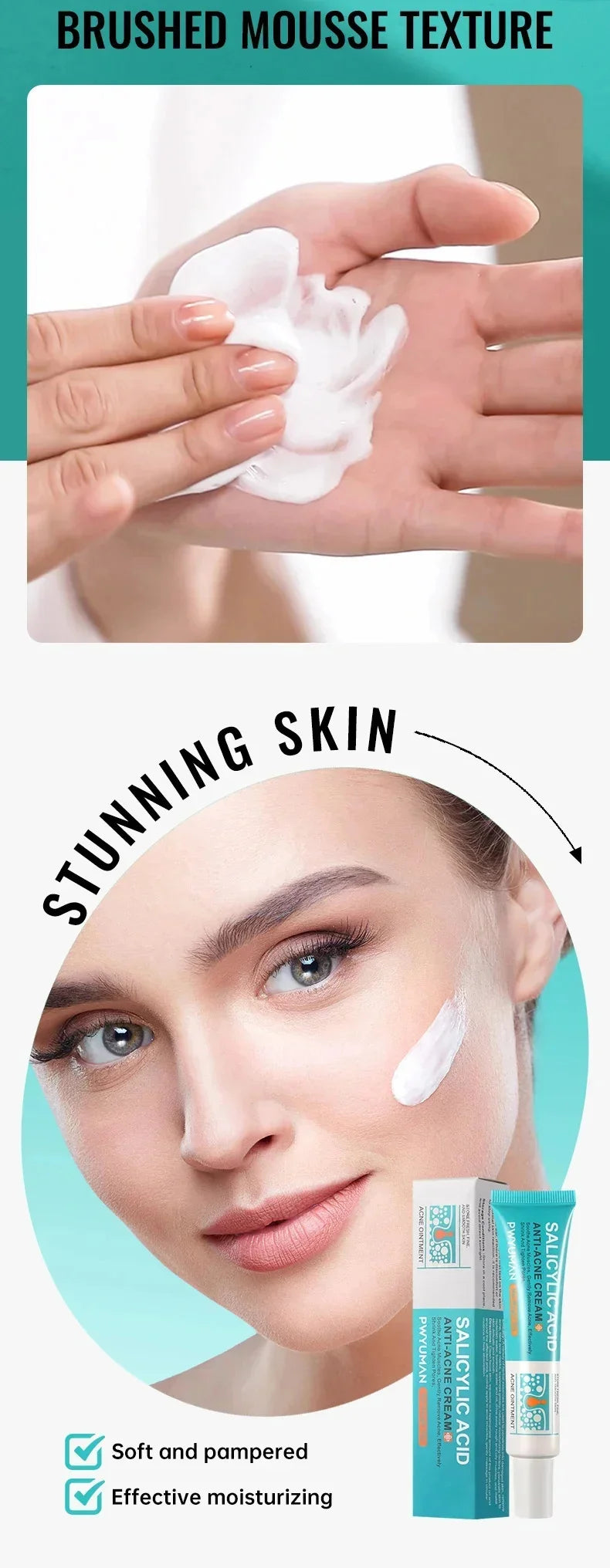 Salicylic Acid Acne Removal Cream - yourelevatedwellness